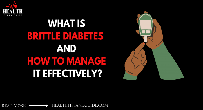 What Is Brittle Diabetes And How To Manage It Effectively?
