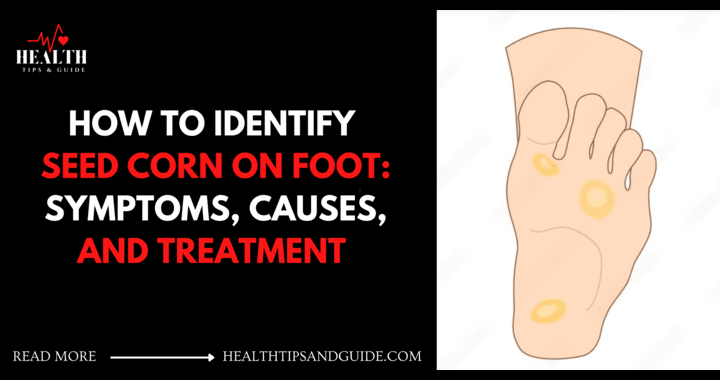 How To Identify Seed Corn On Foot- Symptoms, Causes, And Treatment