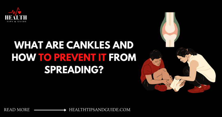 Cankles is the combination of word calf and muscles. It is the condition of swollen feet or edema commonly seen in women of any age group.
