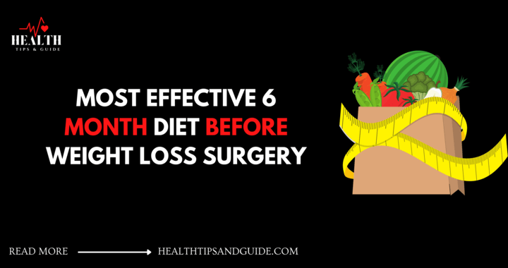 Most Effective 6-Month Diet Before Weight Loss Surgery